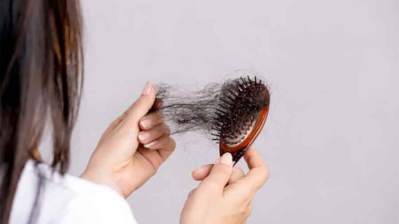 Caída del cabello: Mitos, dietas, preguntas frecuentes y cada vez más gente joven en el consultorio